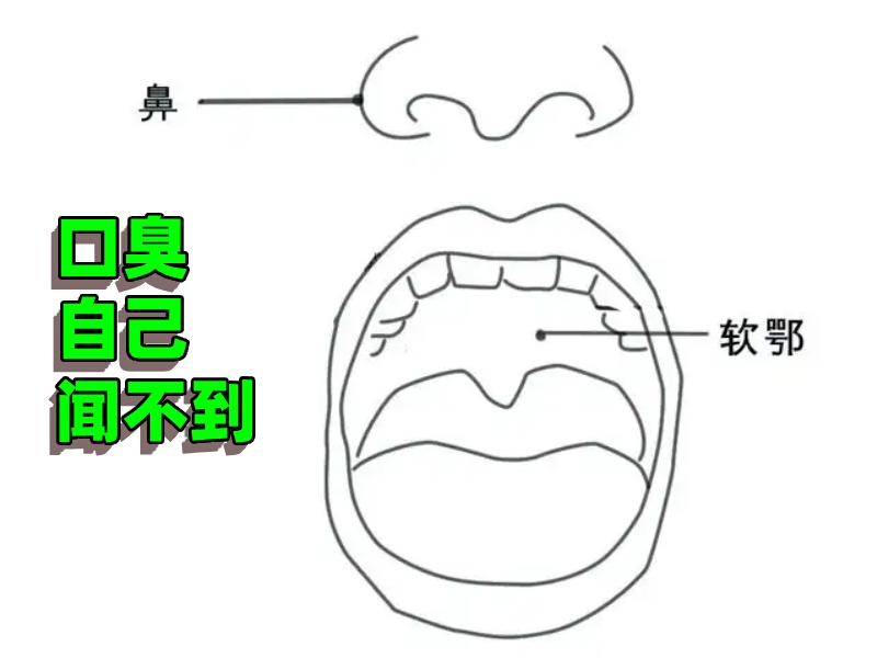 鼻腔结构图